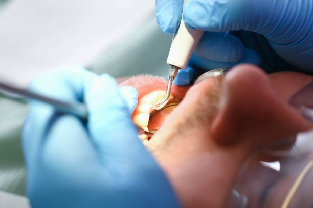 Best Emergency Root Canal Therapy in Berryville, VA