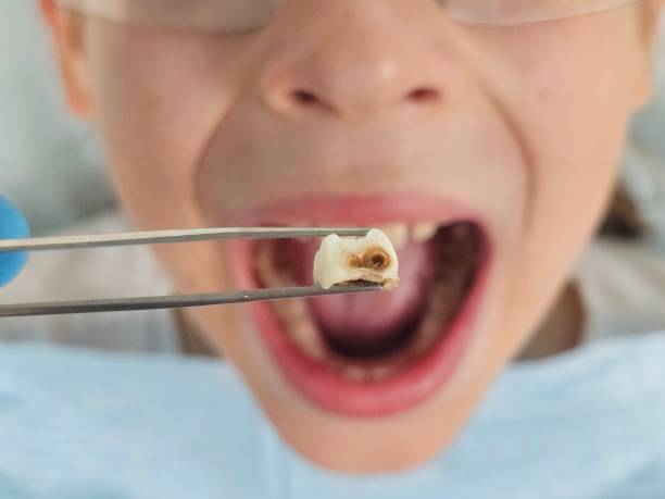 Best Emergency Care for Gum Disease in Berryville, VA
